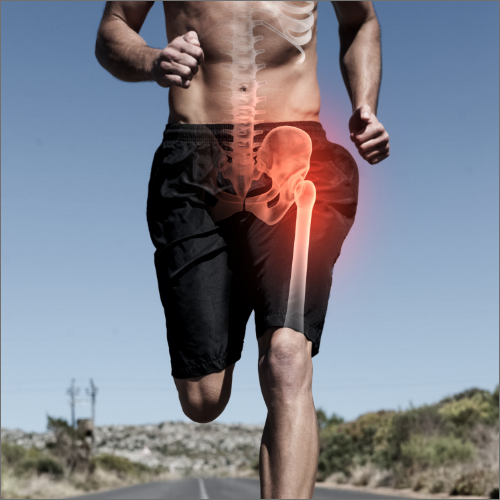 hip-pain-relief-Los-Alamitos-Physical-Therapy-los-alamitos-ca