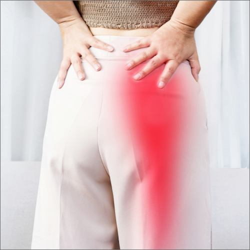 sciatica-relief-Los-Alamitos-Physical-Therapy-los-alamitos-ca