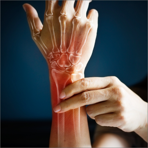 wrist-pain-relief-Los-Alamitos-Physical-Therapy-los-alamitos-ca